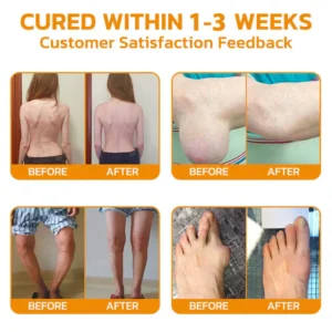 AQA™ Botulinum and Bee Toxin Pain Relief Bone Healing Cream image AQA™ Botulinum and Bee Toxin Pain Relief Bone Healing Cream