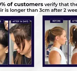 HZA™ Natural Hair Regrowth Spray image HZA™ Natural Hair Regrowth Spray