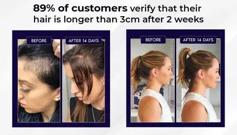 HZA™ Natural Hair Regrowth Spray image HZA™ Natural Hair Regrowth Spray