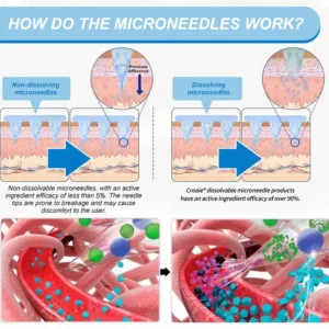 Croaie® GLP-1 Nano-Microneedle Patch with Collagen & Matrixy