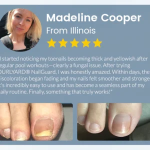 Ourlyard® NailGuard Fungal Repair Herbal Spray