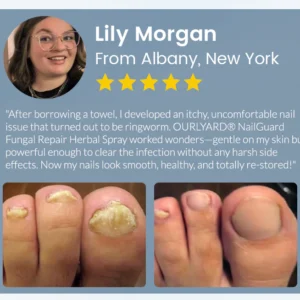 Ourlyard® NailGuard Fungal Repair Herbal Spray