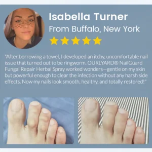 Ourlyard® NailGuard Fungal Repair Herbal Spray