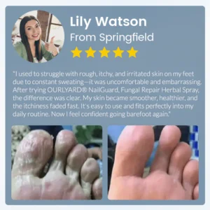 Ourlyard® NailGuard Fungal Repair Herbal Spray