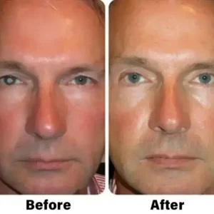NESLEMY™ Nano Vision Repair Eye Serum