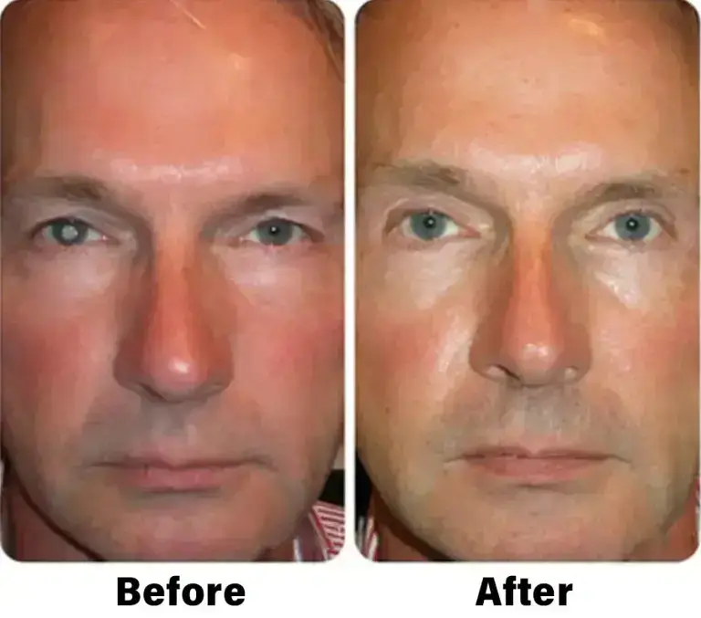 NESLEMY™ Nano Vision Repair Eye Serum