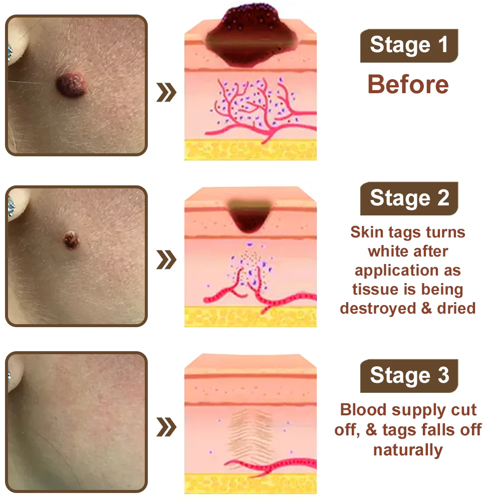 Zvoevo® Black Rice Skin Repair Essence Cream image Zvoevo® Black Rice Skin Repair Essence Cream - Image 11