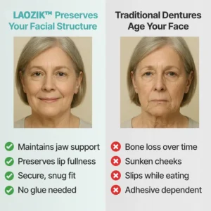 LAOZIK™ Custom-Fit Functional Dentures