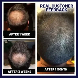 HZA™ Natural Hair Regrowth Spray image HZA™ Natural Hair Regrowth Spray