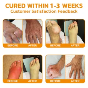 AQA™ Botulinum and Bee Toxin Pain Relief Bone Healing Cream image AQA™ Botulinum and Bee Toxin Pain Relief Bone Healing Cream