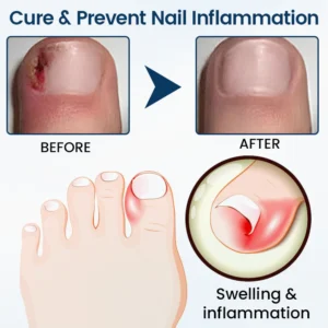 Ourlyard® NailGuard Fungal Repair Herbal Ourlyard® NailGuard Fungal Repair Herbal SpraySpray