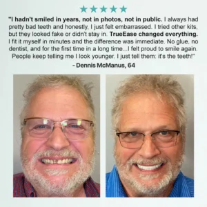 Bikenda® Advanced Customized Full Denture Set