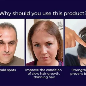 HZA™ Natural Hair Regrowth Spray image HZA™ Natural Hair Regrowth Spray