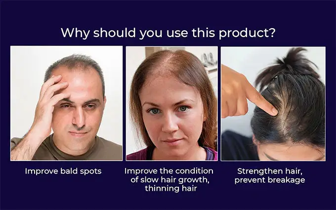 HZA™ Natural Hair Regrowth Spray image HZA™ Natural Hair Regrowth Spray