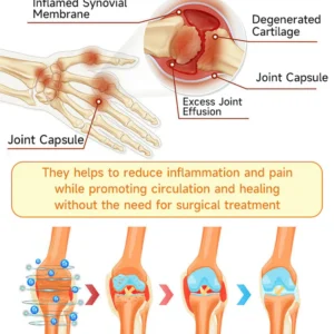 AQA™ Botulinum and Bee Toxin Pain Relief Bone Healing Cream image AQA™ Botulinum and Bee Toxin Pain Relief Bone Healing Cream