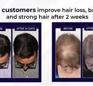 HZA™ Natural Hair Regrowth Spray image HZA™ Natural Hair Regrowth Spray