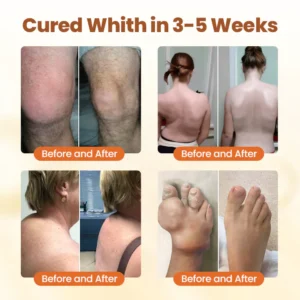 NovaRX® Premium Curcumin Pain Relief Gel