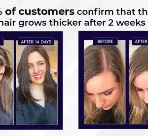 HZA™ Natural Hair Regrowth Spray image HZA™ Natural Hair Regrowth Spray