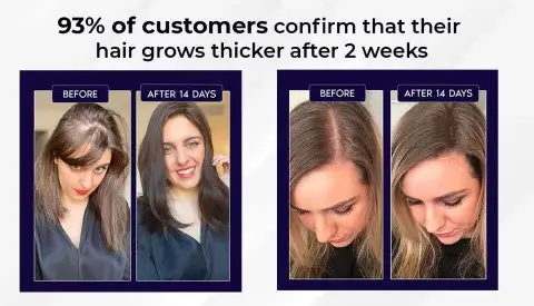 HZA™ Natural Hair Regrowth Spray image HZA™ Natural Hair Regrowth Spray