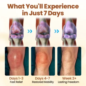 NovaRX® Premium Curcumin Pain Relief Gel