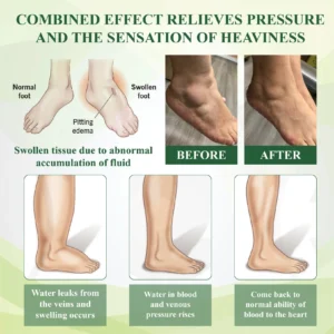 ATTDX® FluidEx Circulation & Drainage Capsules