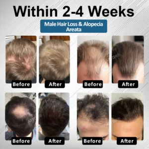 ATTDX® Hair Reawaken PP405 Roll-On Serum