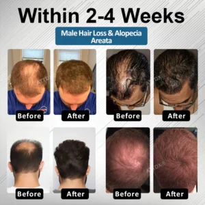 ATTDX® Hair Reawaken PP405 Roll-On Serum