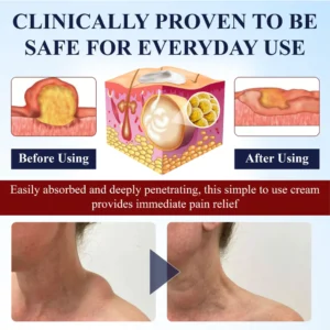 Cvreoz® LipoEase Herbal Matrix