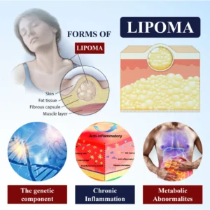 Cvreoz® LipoEase Herbal Matrix