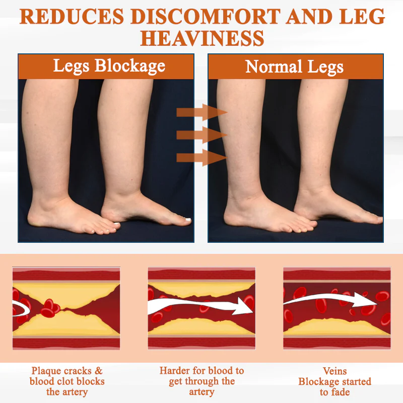 ATTDX® ManukaRelief Edema Therapy Cream