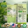 ATTDX® Edema Drain Duo Therapy Roller Cream