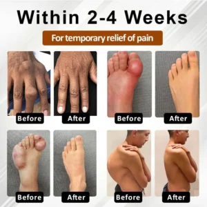 Bazenith™ MagniBee Joint Support Formula Spray