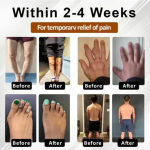 Bazenith™ MagniBee Joint Support Formula Spray