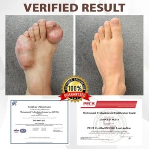 Bazenith™ MagniBee Joint Support Formula Spray