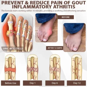 Bazenith™ MagniBee Joint Support Formula Spray