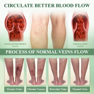 ATTDX® FluidEx Circulation & Drainage Capsules