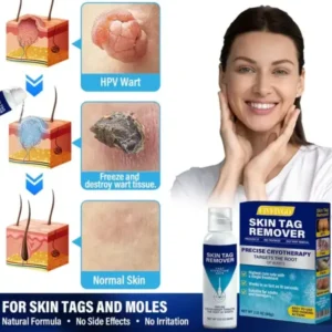 Fivfivgo® TagRecede Cryo Treatment Spray