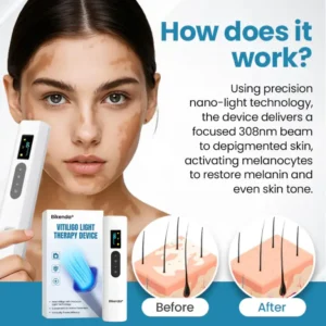Bikenda® Vitiligo Light Therapy Device
