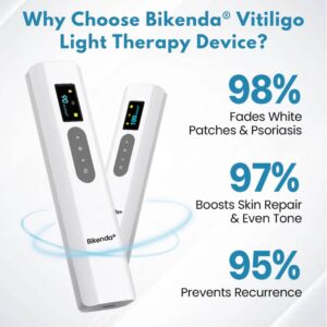 Bikenda® Vitiligo Light Therapy Device