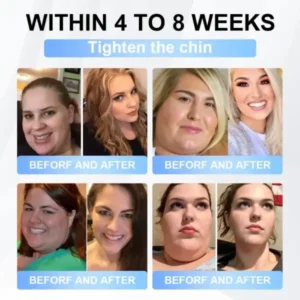 LBMLBM® Tirzepatide Slimming & Health Nano Microneedle Patch