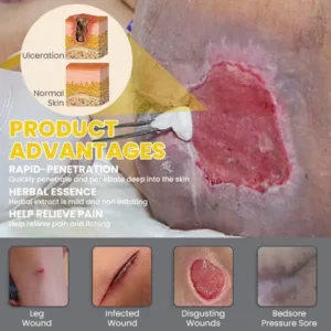 LIMETOW® Bedsore Cream