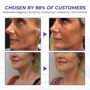 Timilk® ElastaPro Emu Oil Skin Firming Cream