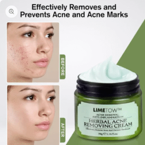LIMETOW™ herbal acne removal cream image LIMETOW™ herbal acne removal cream