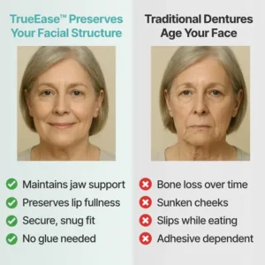TrueEase™ Custom-Fit Functional Dentures