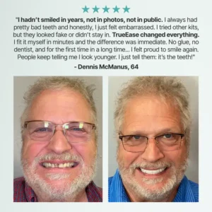 TrueEase™ Custom-Fit Functional Dentures