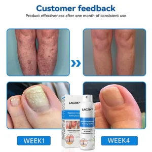 LAOZIK™ Magnesium Herbal Spray