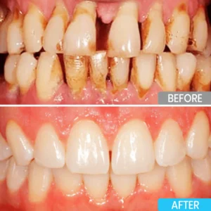 Lyyeto® Focussmile bee venom treatment powder for oral use image Lyyeto® Focussmile bee venom treatment powder for oral use