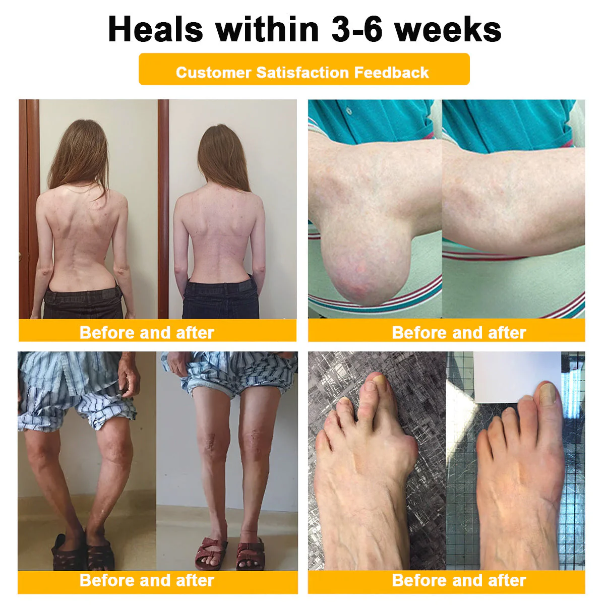 AQA™ Botulinum & Bee Essence Pain Relief Bone Healing Cream - Image 13