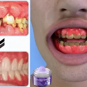 Onyikey™ Teeth Restoration Mineral Powder image Onyikey™ Teeth Restoration Mineral Powder