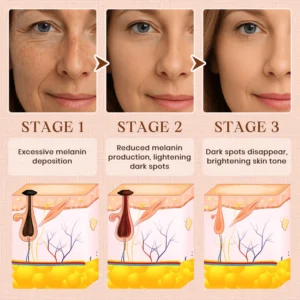 Luhaka® Purifying Exfoliating Gel for Acanthosis Nigricans